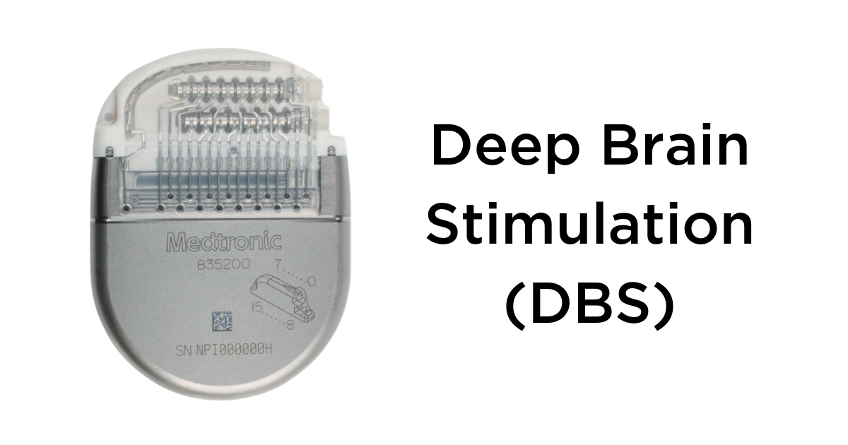 Deep brain stimulation (DBS) with PerceptTM PC device by Medtronic